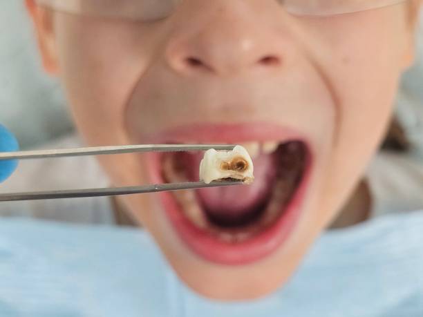 Best 24-Hour Emergency Dentist  in Mked Tree, AR